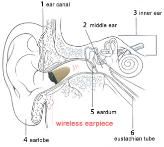 هندزفری داخل کانال گوش